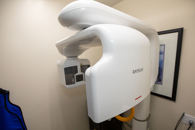 cone beam cbct machine